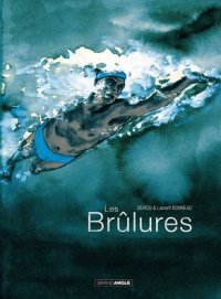 Les br�lures